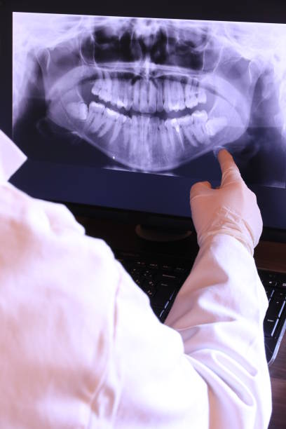 Best Emergency Wisdom Teeth Removal in Hazlehurst, MS