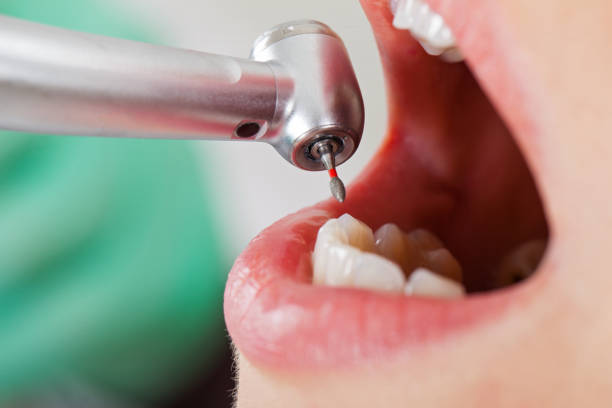 Best Emergency Broken Tooth Repair in Hazlehurst, MS